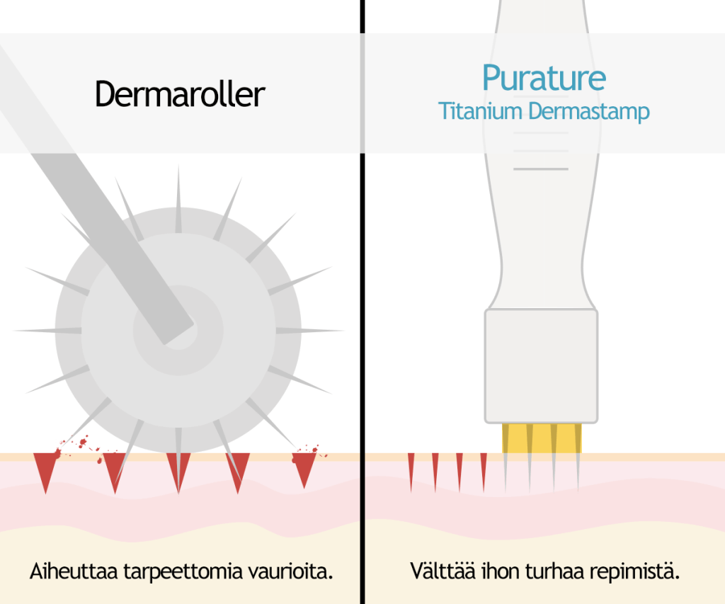 Dermaroller vs. Dermastamp